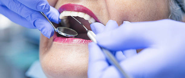 Best Emergency Treatment for Dental Infections or Abscesses in Blanchard, OK
